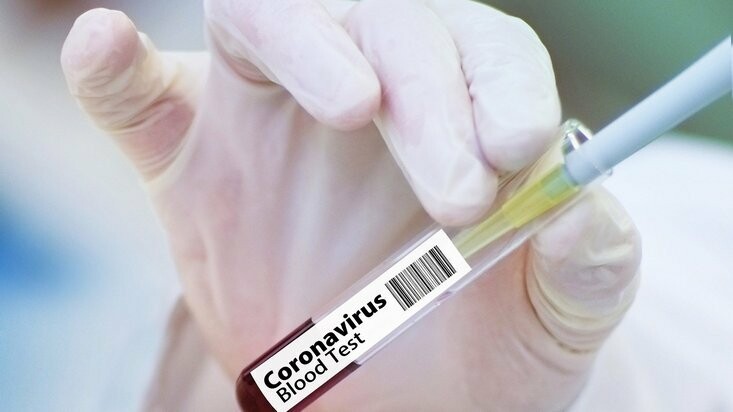 В «ДНР» за сутки коронавирус унес жизни девяти человек, 199 новых случаев