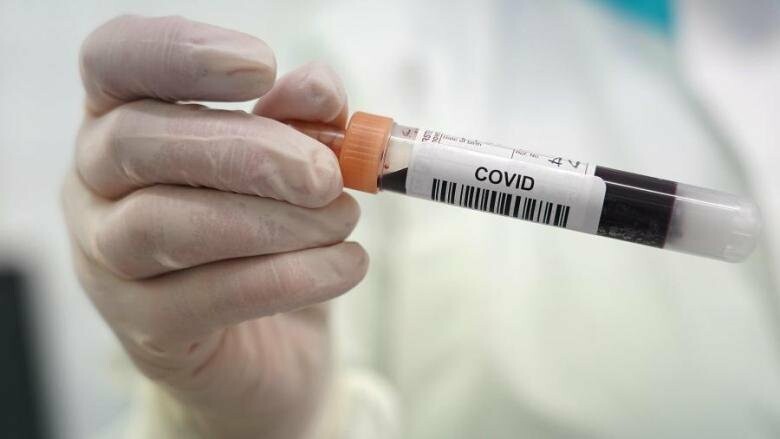 Корнавирус в ОРДО: выявлено 334 новых случая заболевания, 20 человек скончались